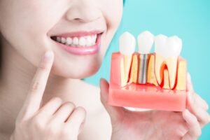 What are the Most Common Dental Misconceptions?