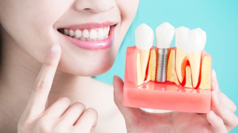 What are the Most Common Dental Misconceptions?