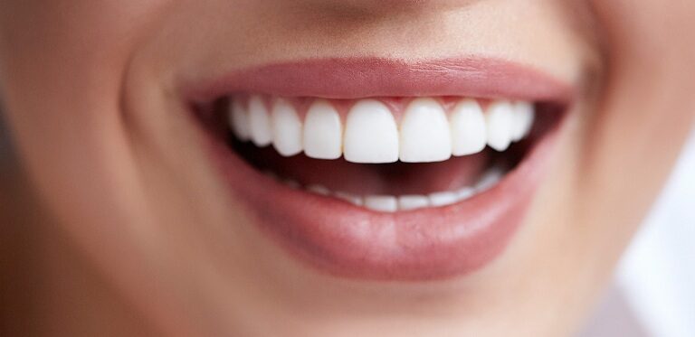 Everything You Need to Know About Cosmetic Dentistry