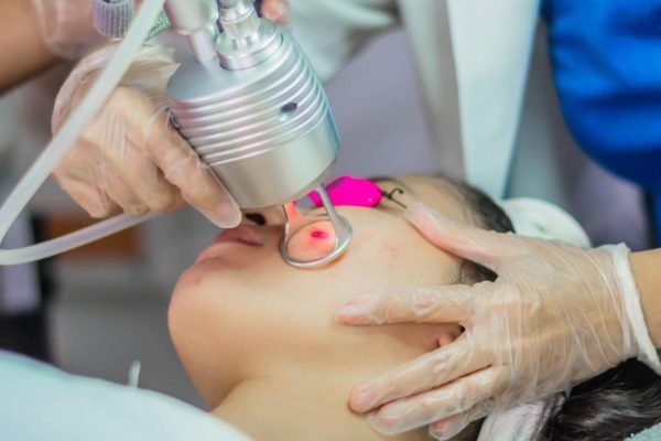 Laser Skin Resurfacing Santa Monica – Things you Need to Know